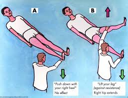 <p>Quando há indicios de paresia do MI → indica <u>perturbação neurológica funcional</u></p>