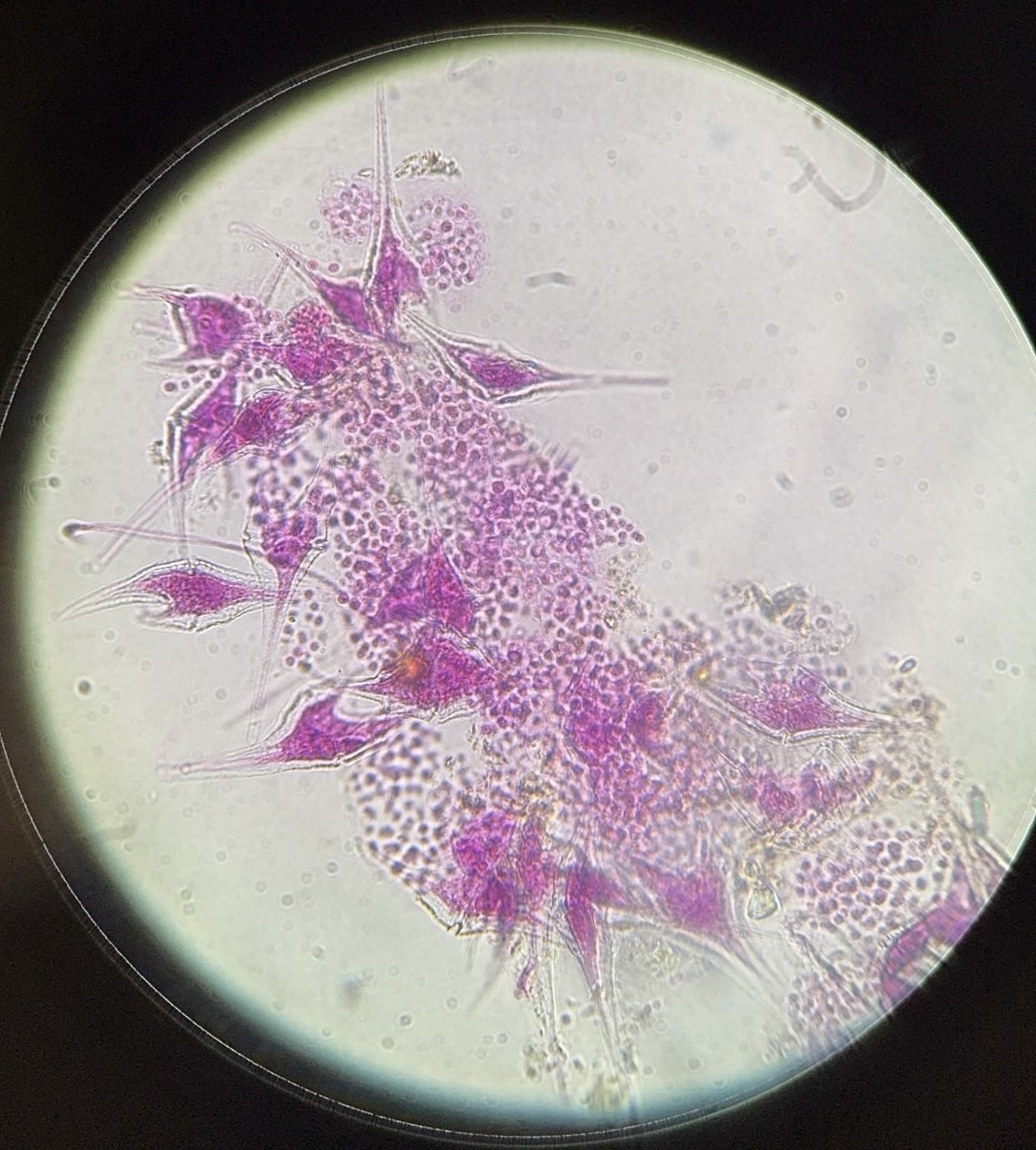 <p><span>What is this organism?</span></p>