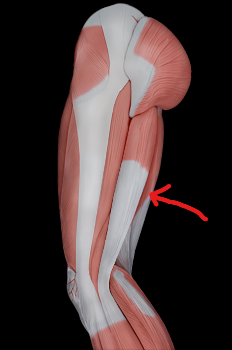 term image