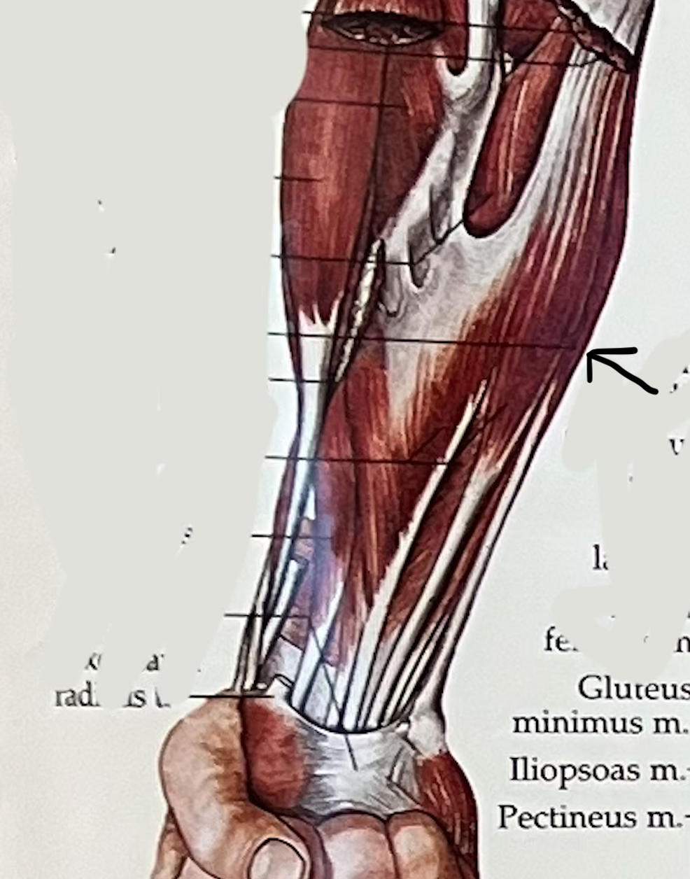what muscle?