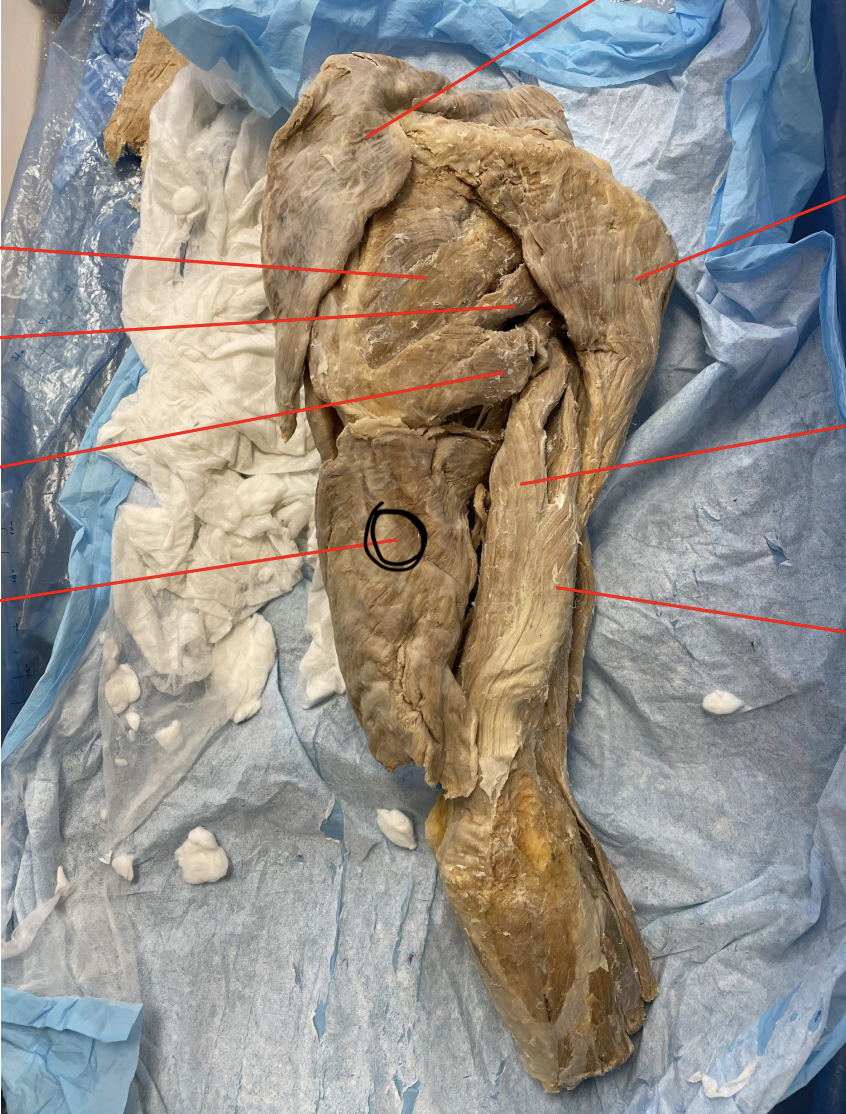 <p>identify + state origin, insertion, action, innervation of marked structure</p>