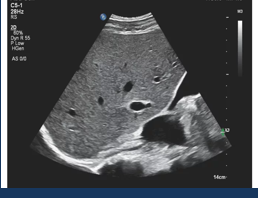 <p>-smooth</p><p>-uniform texture (normal liver)</p>