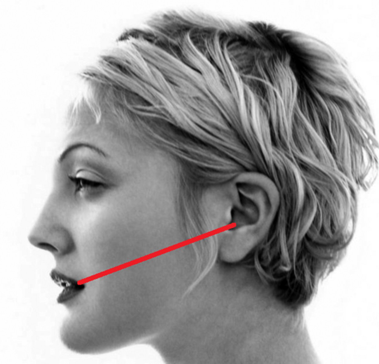 <p>Lips-meatal line</p>
