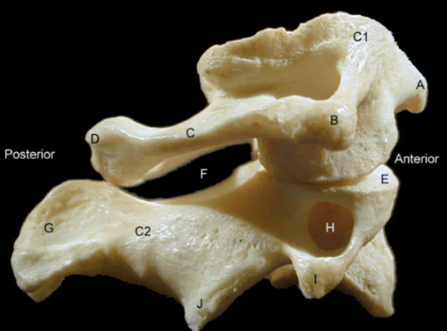 <p>Identify the Structures of the Cervical Vertebrae - Lateral View</p>