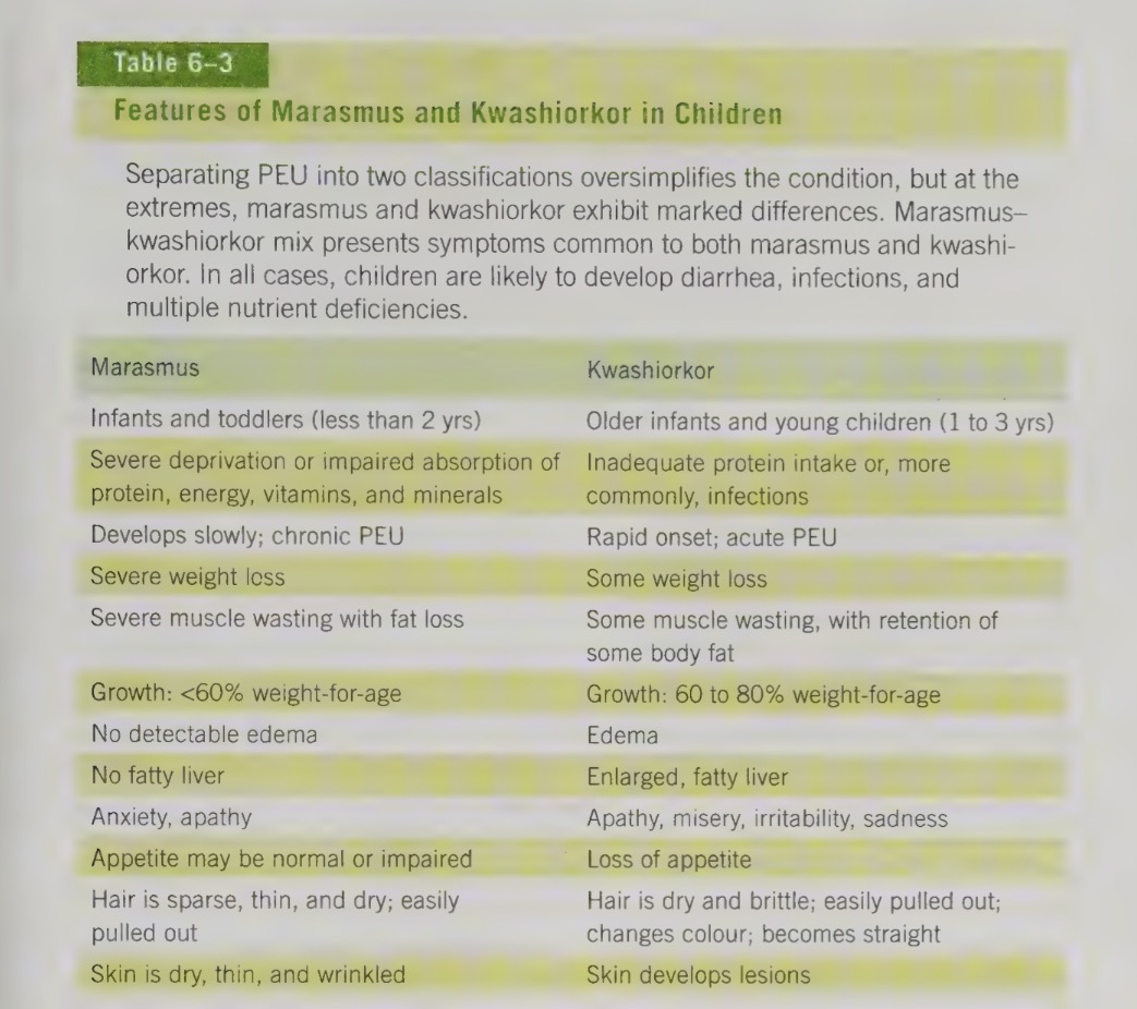 <ul><li><p>marasmus and kwashiorkor</p></li></ul><p></p>