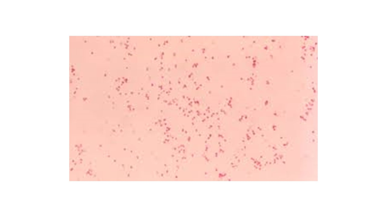 <p>l<span>ooking at the micrograph, is Moraxella catarrhalis Gram positive or Gram negative</span></p>