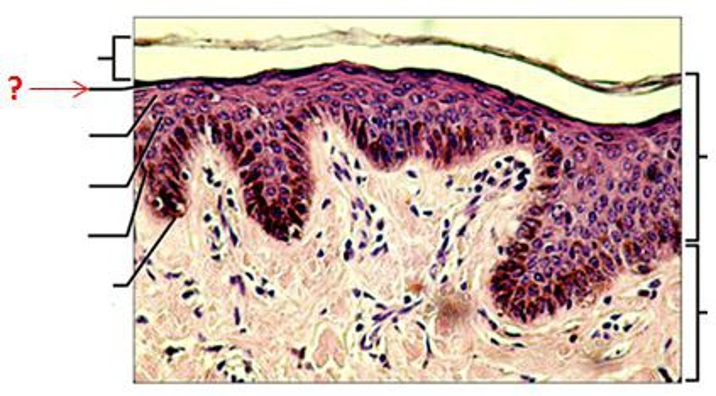 <p>a layer of the epidermis found only in the thick skin of the fingers, palms, and soles</p>
