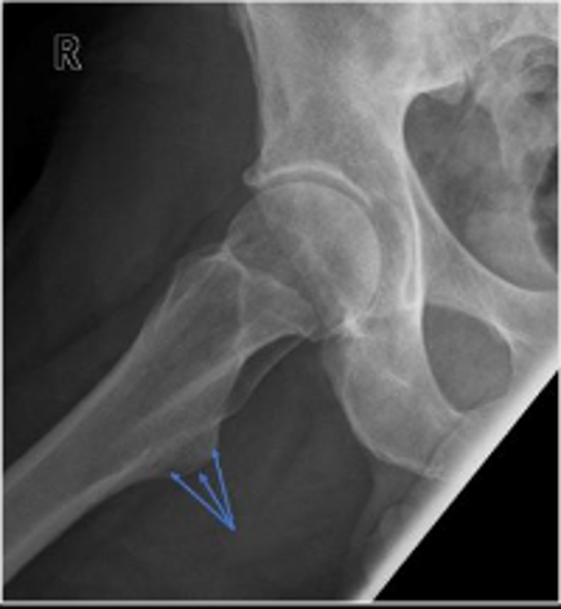 <p>What are the arrows pointing to?</p>