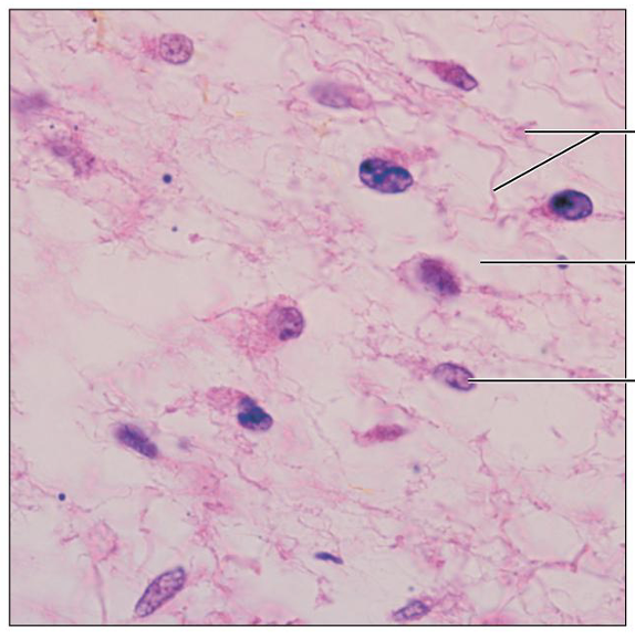 <p>What is this tissue, and where is it found?</p>