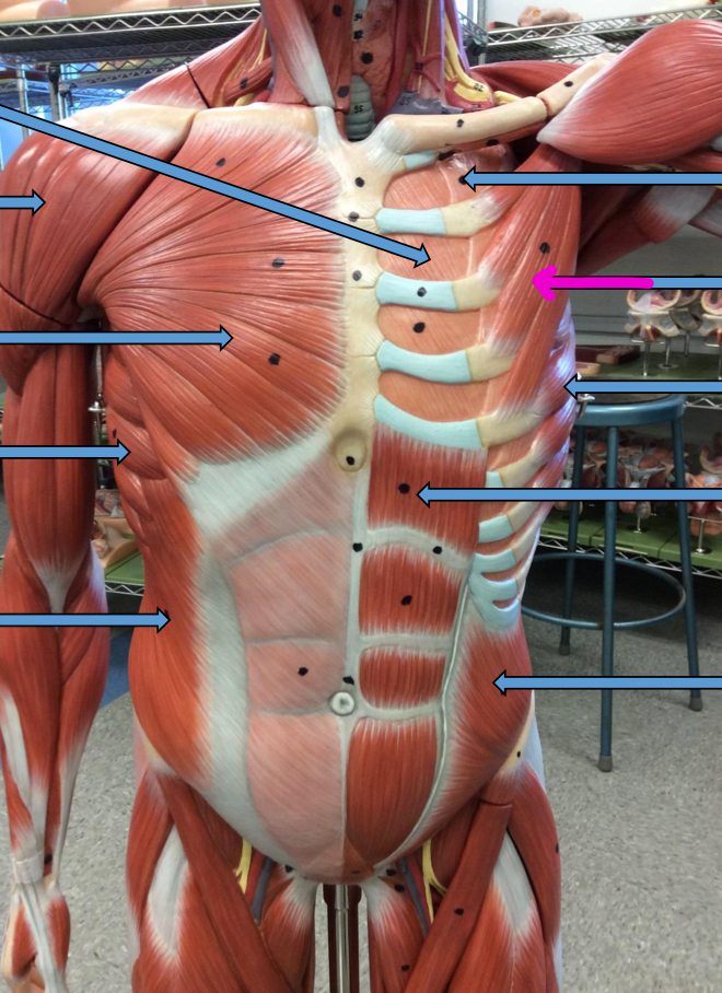 <p>Identify this muscle?</p>