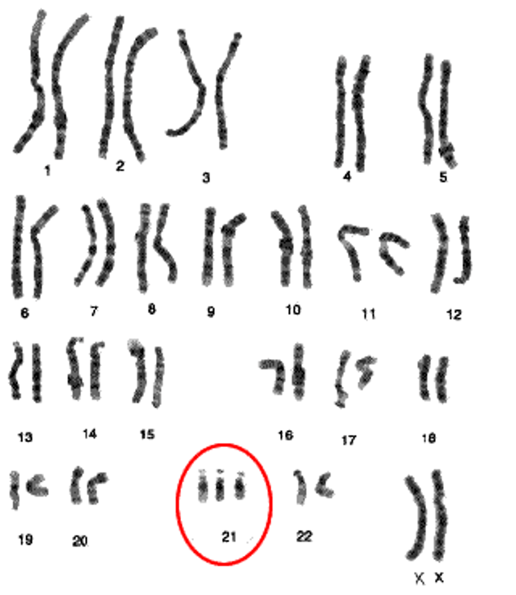 <p>when a cell or organism varies in the usual amount of chromosomes in its genome by the addition or loss of a chromosome</p>