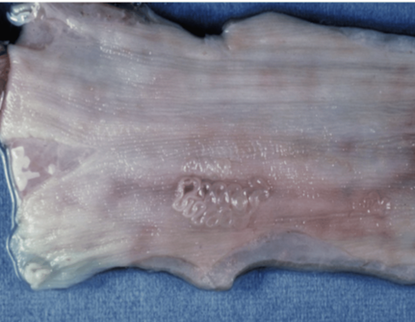 <p>what is this parasite in this esophagus? this animal had what disease?</p>