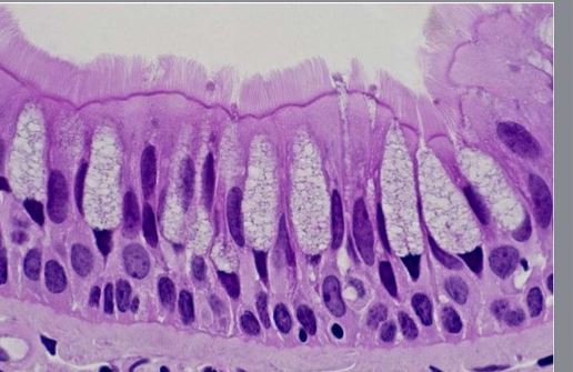 <p>Location Reparatory Tract</p><p>Function: moves mucus </p>