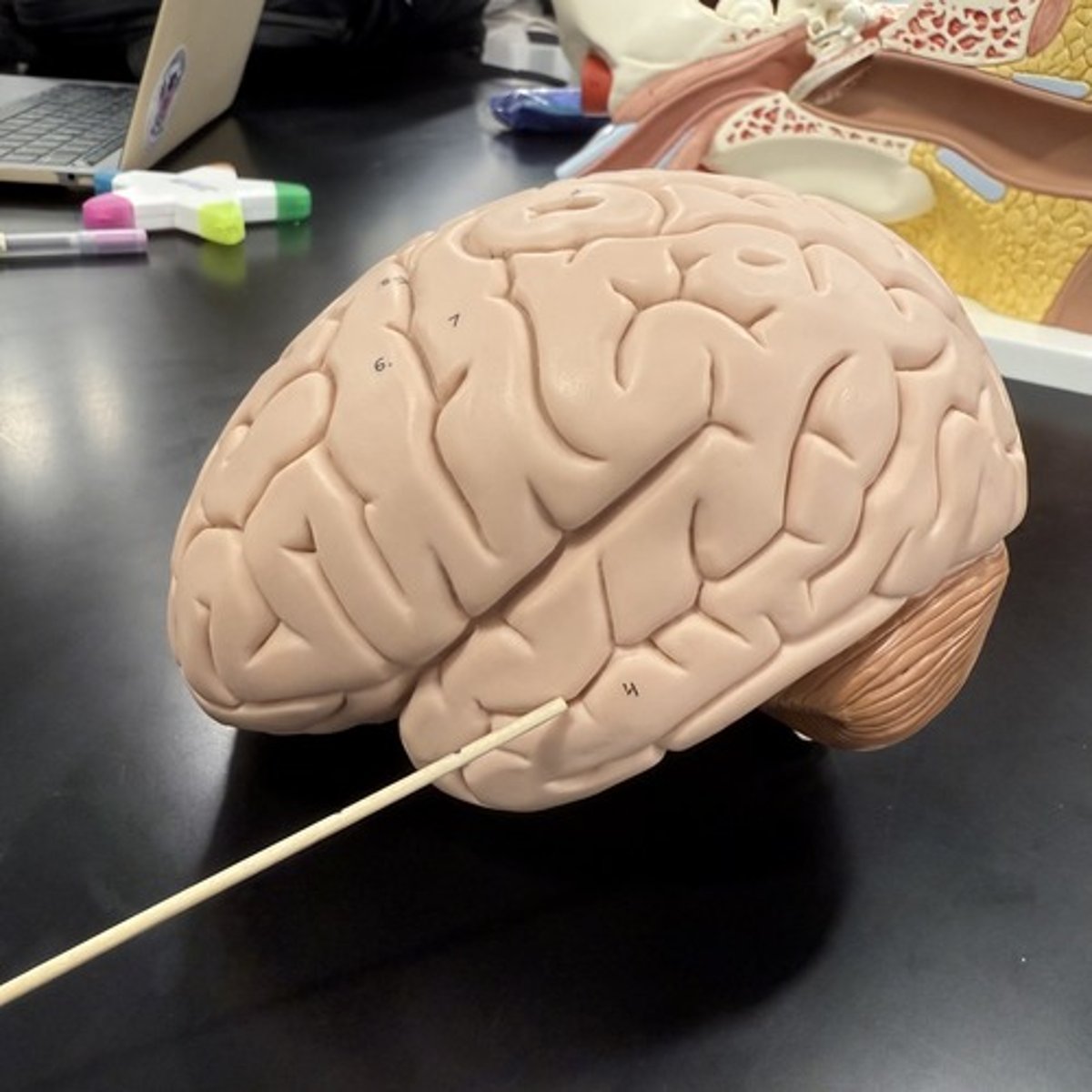 <p>What is this lobe of the cerebrum?</p>