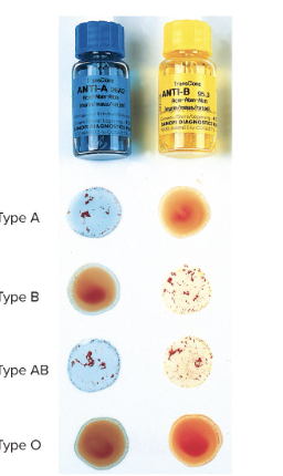 <ul><li><p>use Antibodies anti-A and anti-B and mix with samples of the blood</p></li><li><p>You DO NOT form antibodies against your antigens, so your blood will mix with the antibodies and clot if your RBCs have the antigen</p></li></ul><p></p>