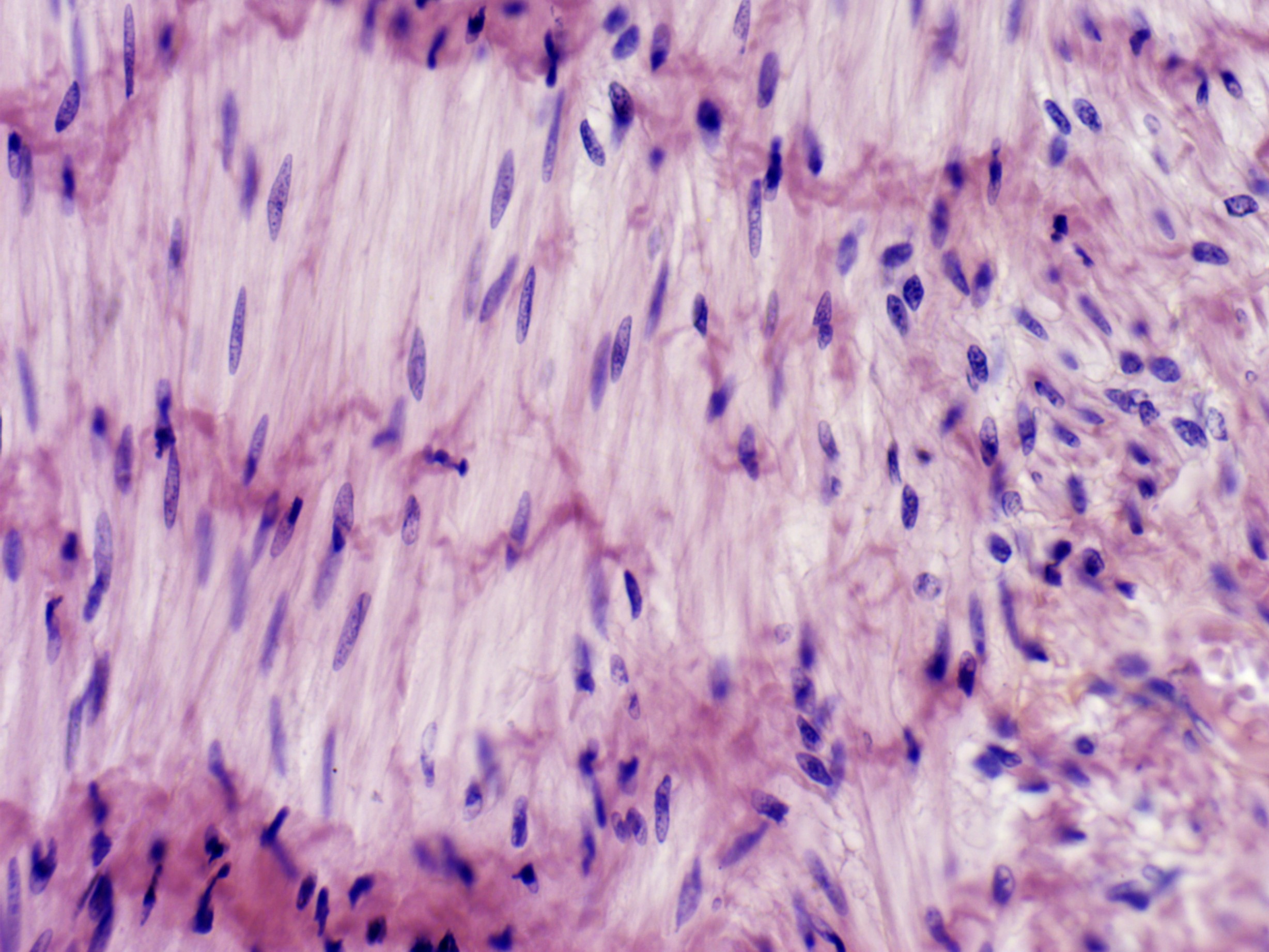 <p>How to identify a smooth muscle tissue?</p>