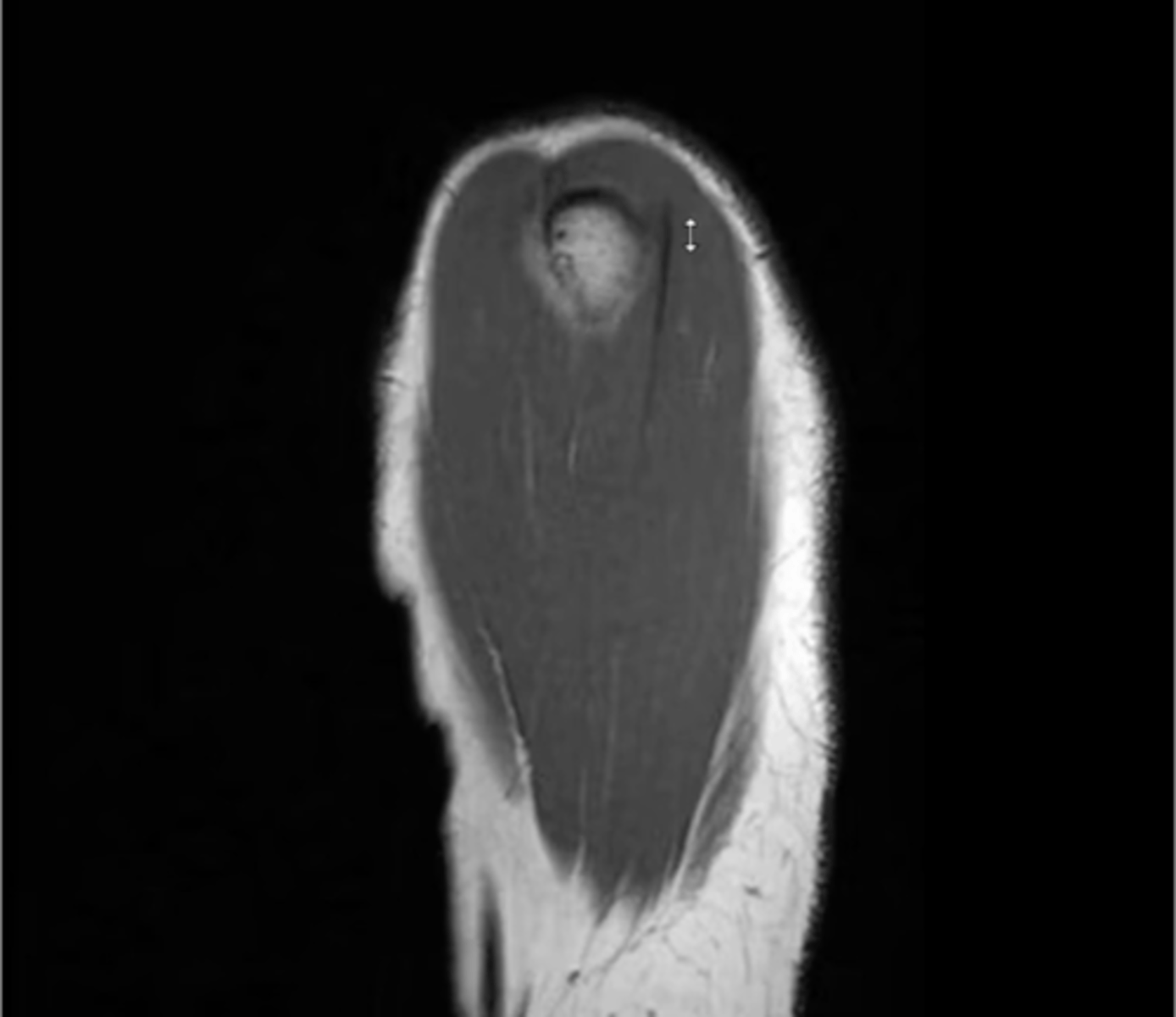 <p>What type of view is this?</p>