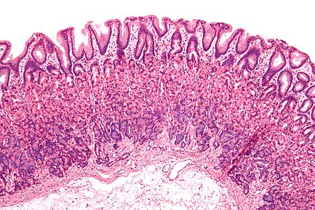 <p>Gastric Pit </p>