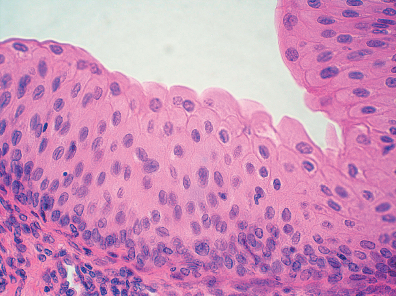 <p>Specialized epithelial tissue found only in the urinary tract </p>