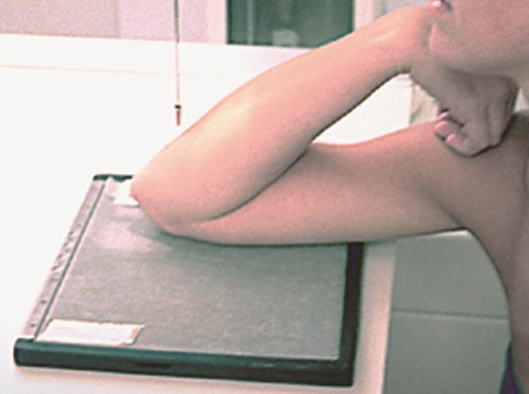 <p>tangential: acute flexion (aka jones position) (elbow)</p><ul><li><p>CR 2in distal from olecranon </p></li></ul><p></p>