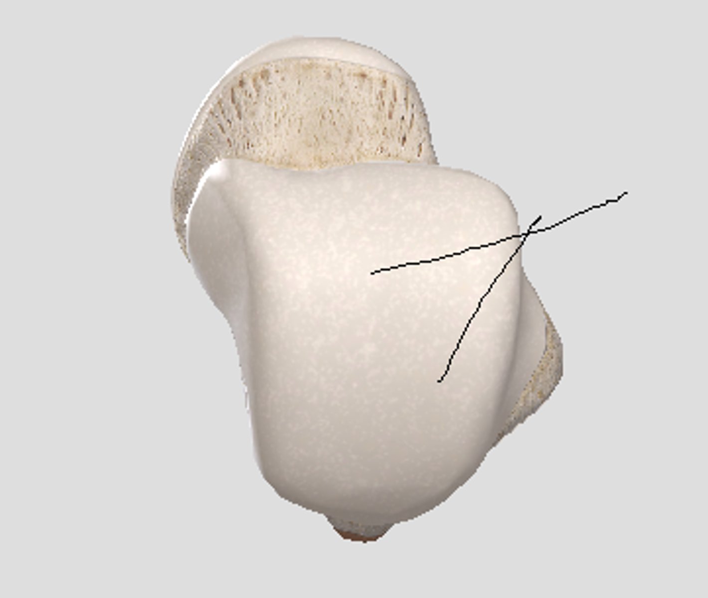 <p>attachment surface for tibia</p>