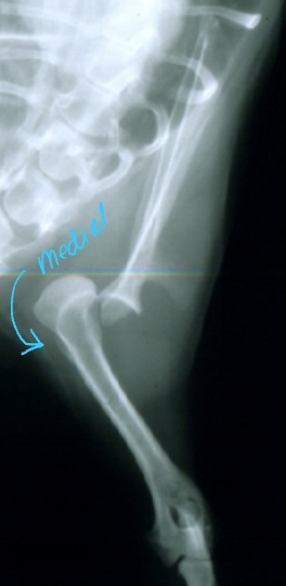 <ul><li><p><span style="background-color: transparent;"><strong><span>Et: </span></strong><span>congenital or trama</span></span></p><ul><li><p><span style="background-color: transparent; color: red;"><span>Ligamentous laxity, Glenoid dysplasia</span></span></p></li></ul></li><li><p><span style="background-color: transparent;"><strong><span>Sig: </span></strong><span>Young small breeds (congenital)</span></span></p></li><li><p><span style="background-color: transparent;"><strong><span>Cs:</span></strong><span> lameness</span></span></p></li><li><p><span style="background-color: transparent;"><strong><span>Tx: </span></strong></span></p><ul><li><p><span style="background-color: transparent;"><strong><span>Congenital:</span></strong><span> MCL repair, arthroplasty</span></span></p></li><li><p><span style="background-color: transparent;"><strong><span>Acquired: Medial,</span></strong><span> Closed reduction, Bandage 2 weeks, rest 2 weeks, sling, MCL repair</span></span></p><ul><li><p><span style="background-color: transparent;"><strong><span>Velpeau sling: </span></strong><span>for </span></span><span style="background-color: transparent; color: red;"><span>medial luxation</span></span></p></li><li><p><span style="background-color: transparent;"><strong><span>Neutral sling:</span></strong><span> for </span></span><span style="background-color: transparent; color: red;"><span>lateral luxation</span></span></p></li></ul></li><li><p><span style="background-color: transparent;"><strong><span>Salvage: </span></strong><span>Arthrodesis, Glenoid excision</span></span></p></li></ul></li></ul><p></p>