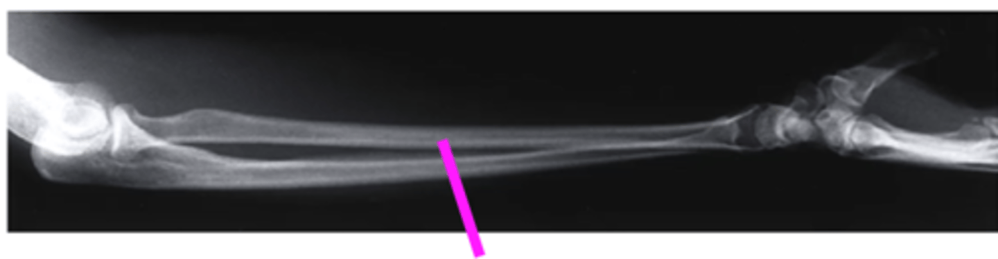 <p>what does this pink line point to?</p>