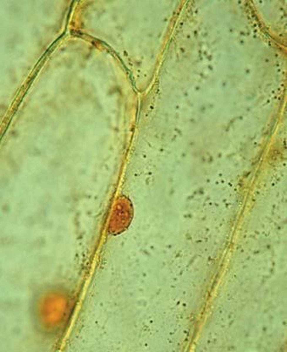 <p>The pressure exerted by the rigid cell wall is a significant factor in determining the net movement of water.</p>