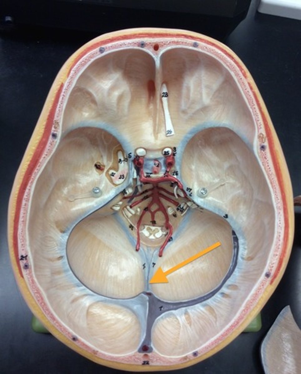 <p>separates the two hemispheres of the cerebellum</p>