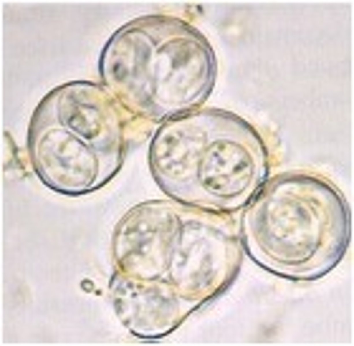 <p>The oocysts are likely Toxoplasma gondii and have zoonotic potential when sporulated</p><p>3 multiple choice options</p>