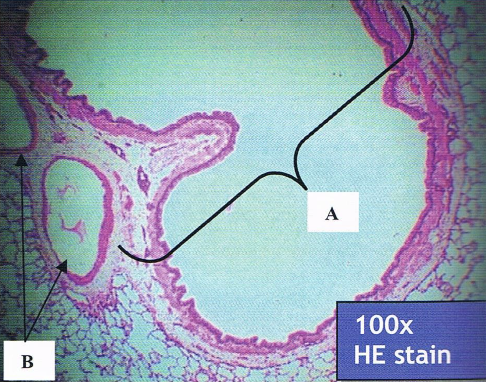 <p>Identify the structure</p>