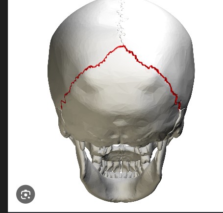 <p>SUTURE</p>