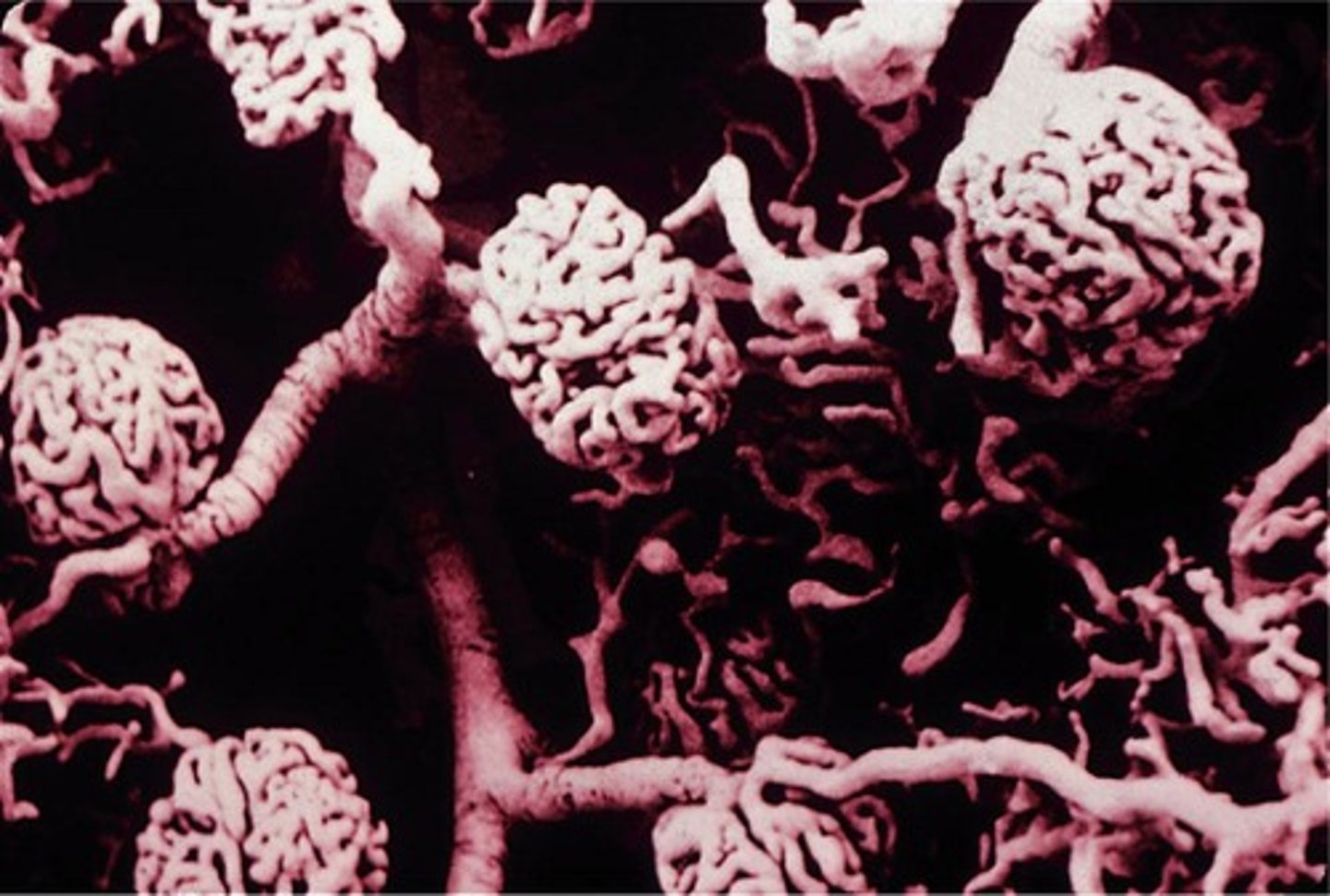 <p>The glomerulus is a capillary bed that filters blood.</p>