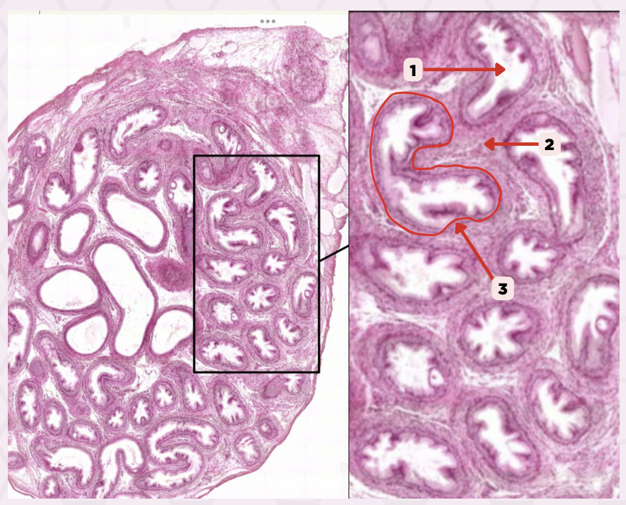 <p>Identify the structure labeled as 1.</p>