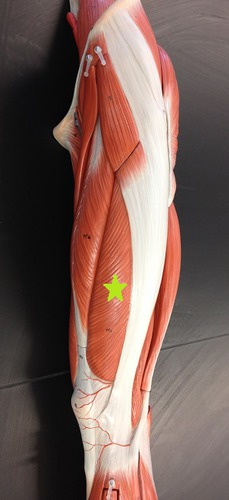 <p><strong>Vastus Lateralis</strong> <sub><sup>(mon-articular muscle; anterior compartment of the thigh) </sup></sub></p><ul><li><p><span style="color: #2ff916">Origin</span>: Shaft of Femur</p></li><li><p><span style="color: #0db1ff">Insertion</span>: Patella </p></li><li><p><span style="color: #ff0000">Action</span>: <strong>Extend</strong> Knee</p></li></ul><p></p>