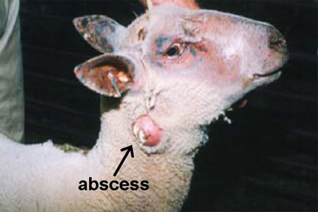 affects the lymphatic system, bacterial disease, infectious, abscess forms when lymph nodes cut or ruptured, pus spreads the bacteria