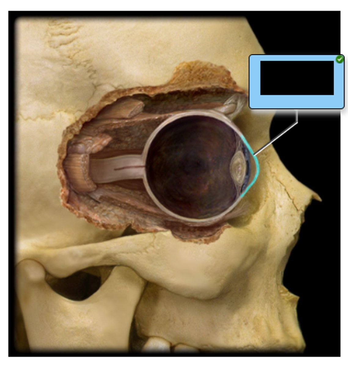 <p>Which structure is comprised of transparent connective tissue?</p><p>a. Ciliary body</p><p>b. Choroid</p><p>c. Anterior chamber</p><p>d. Lens</p><p>e. Sclera</p><p>f. Cornea</p>