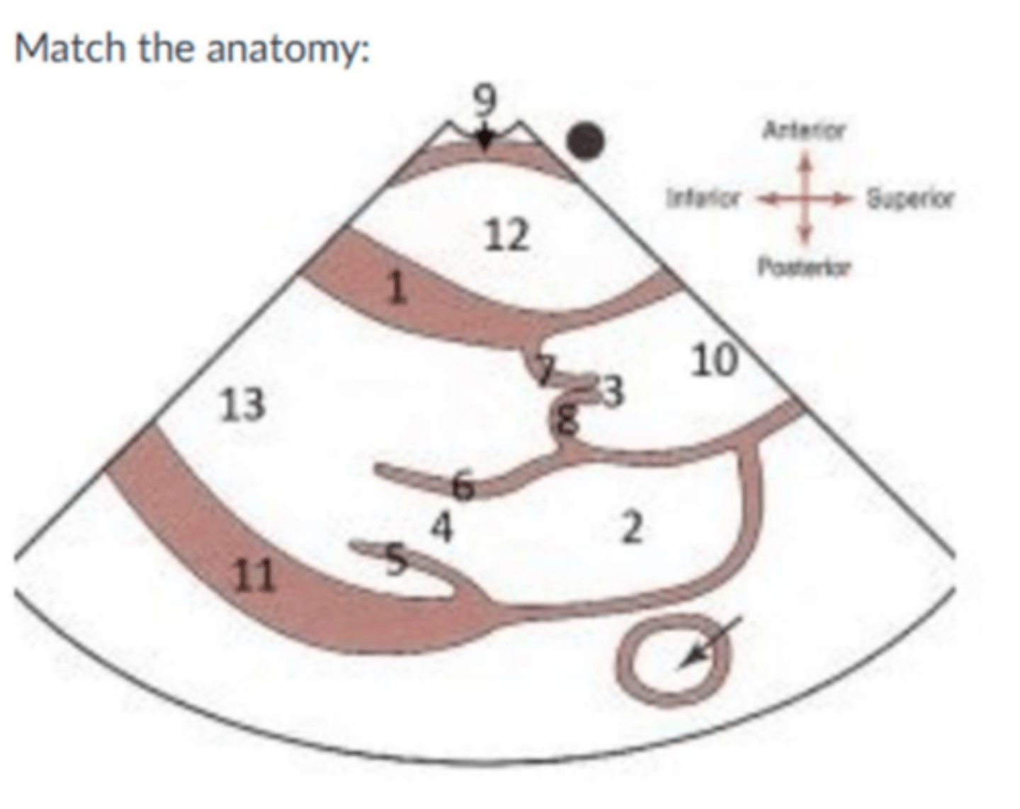 <p>1. IVS</p><p>2. LA</p><p>5. PMVL</p><p>6. AMVL</p><p>7. RCC</p><p>8. NCC</p><p>10. Aorta</p><p>11. LVPW</p><p>12. RV</p><p>13. LV</p><p>9. RV free wall</p>