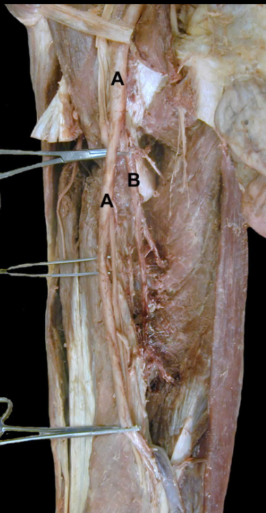 <p>A</p>