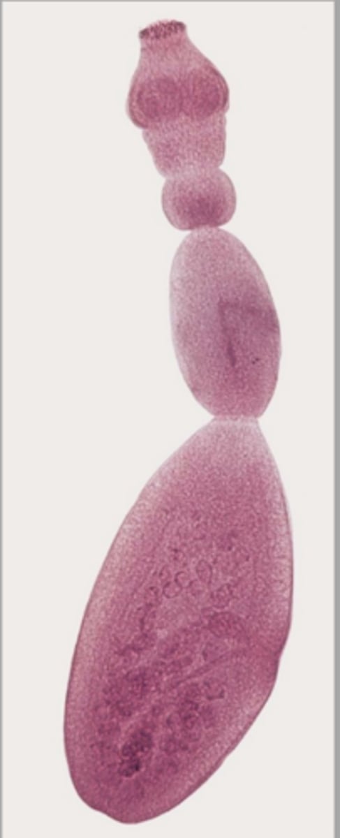 <p>These proglottids were found in the GI contents of a coyote from the Great Smokey Mountains during necropsy. What parasite is this?</p>
