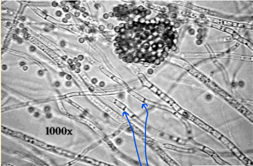 <p>What does this image show?</p>