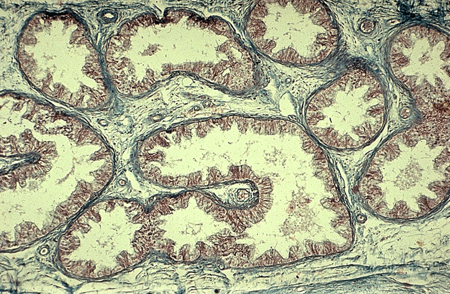 <p class=""><strong>ductuli efferentes</strong></p><ul><li><p class=""><strong>Wavy or scalloped lumen</strong></p></li><li><p class="">Lined by <strong>alternating tall ciliated and short non-ciliated simple columnar cells</strong></p></li><li><p class=""><strong>Thin smooth muscle layer</strong> around each duct</p></li><li><p class="">Found between <strong>rete testis</strong> and <strong>epididymis</strong></p></li></ul><p></p>