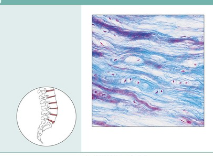 Fibrocartilage
