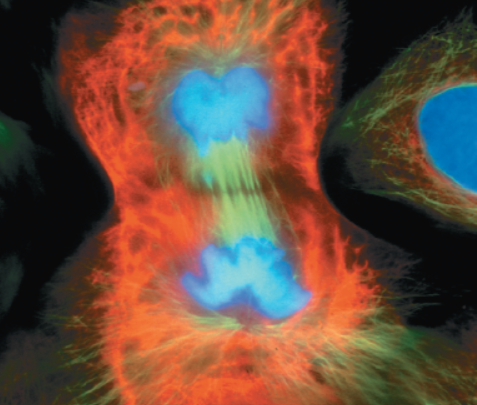 <p>What stage of mitosis is shown here?</p>