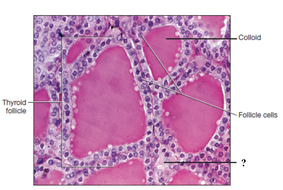 <p>large, pale stained cells between or adjacent to the follicles </p>