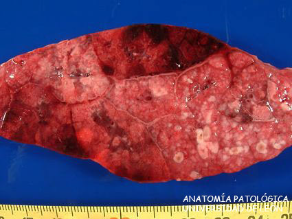 <p>Neumonía fibrinosa. Ovino.</p>