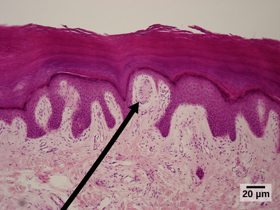 <p><strong>What is the sensory receptor indicated by the green arrow?</strong></p>