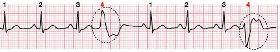 <p>What rhythm is this?</p>