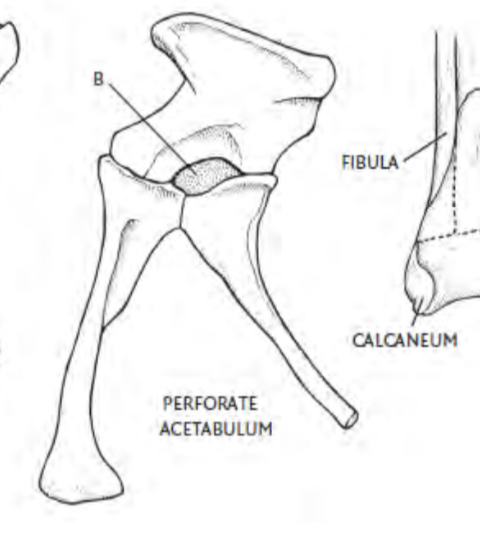 The perforate acetabulum (hole in the hip socket)