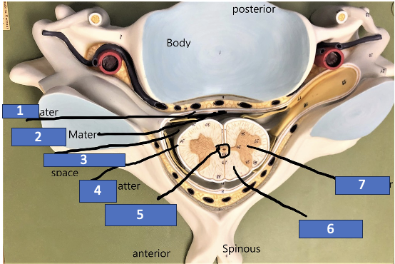 <p>What structure is labeled 2?</p>